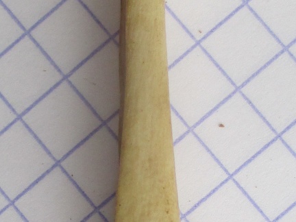 Ulna G dist2 (15319 visites) Ulna G dist2