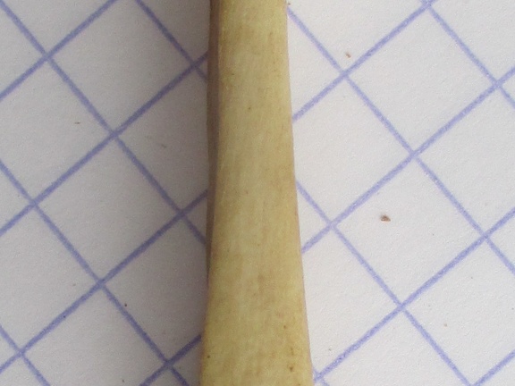 Ulna G dist2 (15387 visites) Ulna G dist2