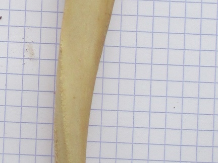 Ulna G lat (15475 visites) Ulna G lat