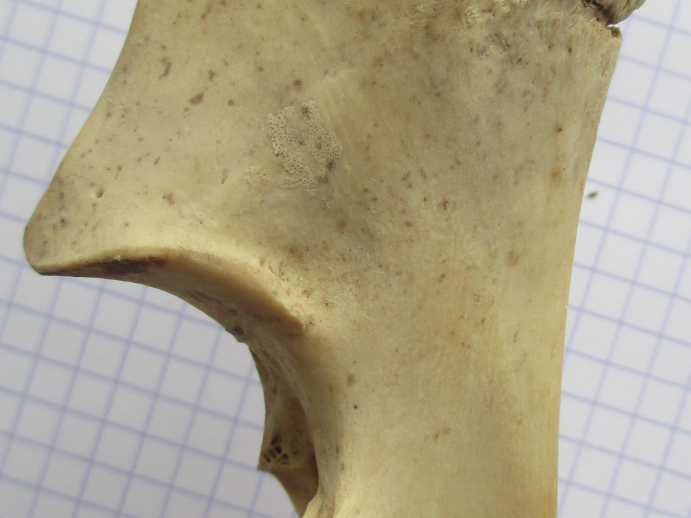 Ulna G prox lat1 (13549 visites) Ulna G prox lat1