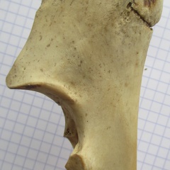 Ulna G prox lat1 (13543 visites) Ulna G prox lat1