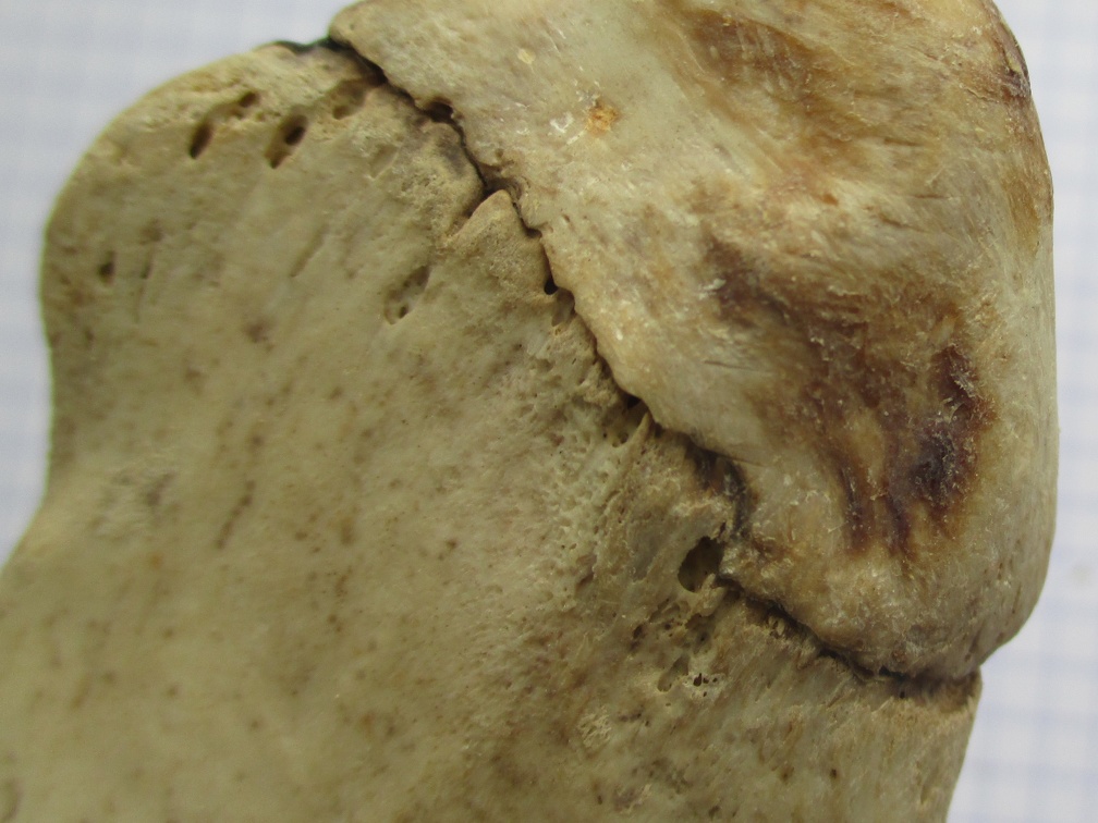 Ulna G prox lat2 (13693 visites) Ulna G prox lat2