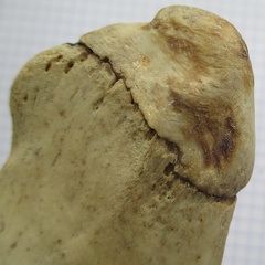 Ulna G prox lat2 (13688 visites) Ulna G prox lat2