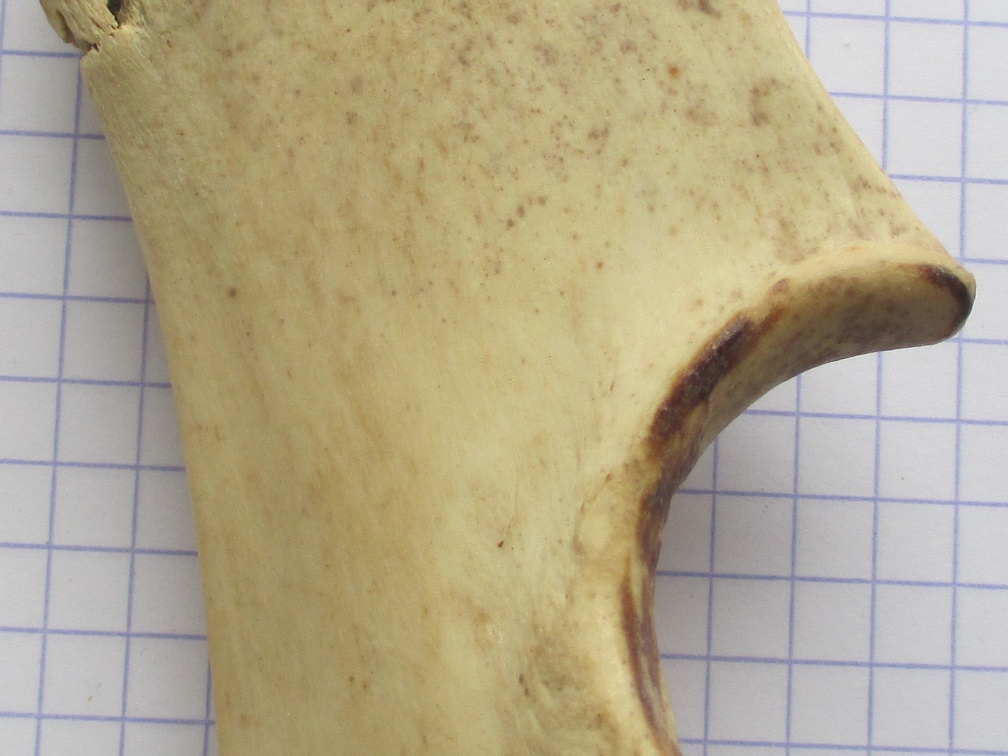 Ulna G prox med (13379 visites) Ulna G prox med