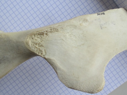 Coxal D illium dors (11651 visites) Coxal D illium dors