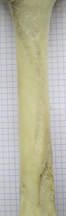 Fémur D diaph