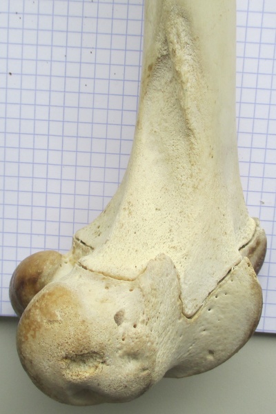Fémur D dist lat - Fémur_D_dist_lat.JPG Fémur_D_dist_lat.JPG