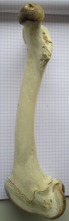 Fémur D med