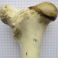 Fémur D prox cran (12152 visites) Fémur D prox cran