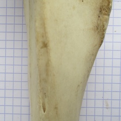 Tibia D diaphyse1 (15221 visitas) Tibia D diaphyse1