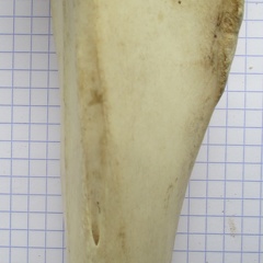 Tibia D diaphyse1