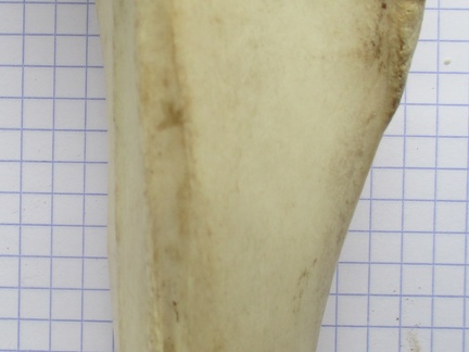 Tibia D diaphyse1 (15195 visits) Tibia D diaphyse1