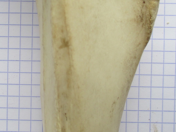 Tibia D diaphyse1 (15245 visites) Tibia D diaphyse1