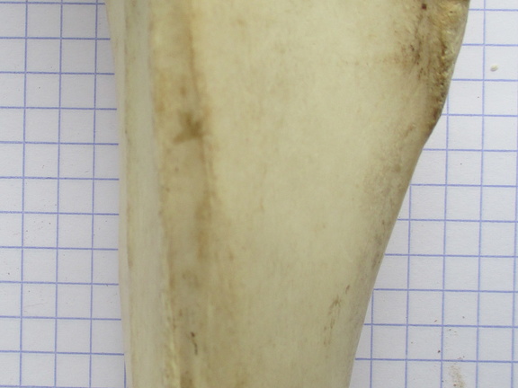 Tibia D diaphyse1