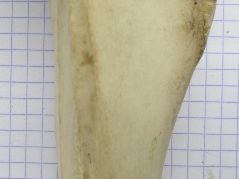 Tibia D diaphyse1 (15215 visites) Tibia D diaphyse1