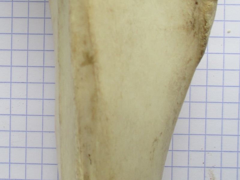 Tibia D diaphyse1