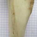 Tibia D diaphyse1