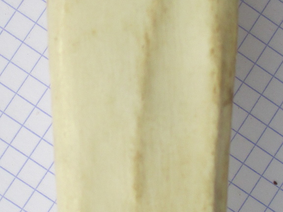 Tibia D diaphyse2 (15283 visites) Tibia D diaphyse2