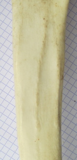 Tibia D diaphyse2