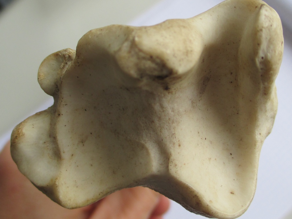 Tibia D dist (16144 visites) Tibia D dist