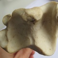 Tibia D dist