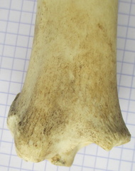 Tibia D dist caud