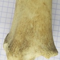 Tibia D dist caud (12375 visites) Tibia D dist caud