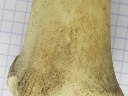 Tibia D dist caud (12373 visits) Tibia D dist caud
