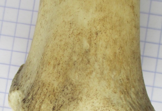 Tibia D dist caud (12385 visites) Tibia D dist caud