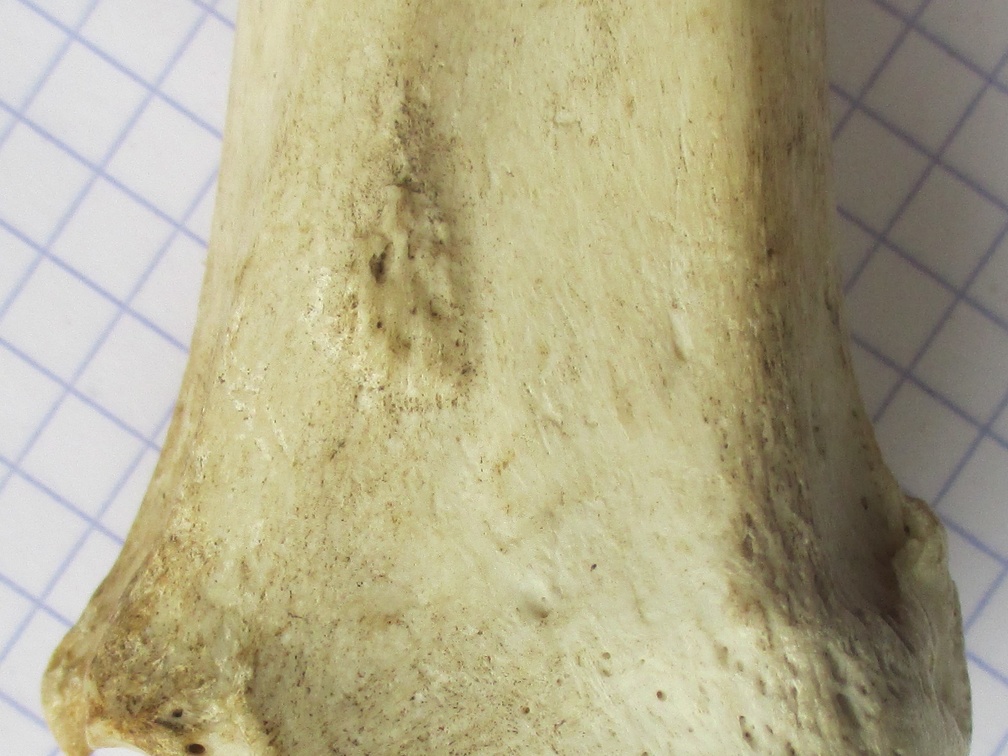 Tibia D dist cran (12765 visites) Tibia D dist cran