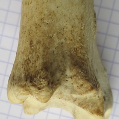 Tibia D dist lat (12691 visites) Tibia D dist lat