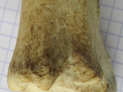 Tibia D dist lat (12673 visits) Tibia D dist lat