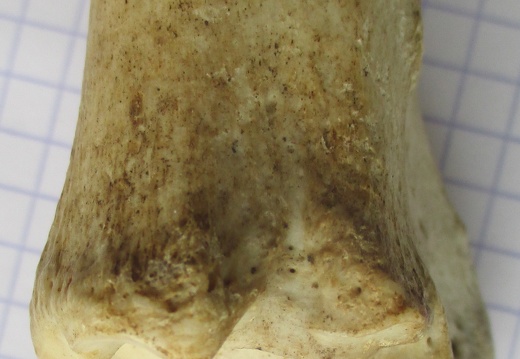 Tibia D dist lat (12674 visites) Tibia D dist lat