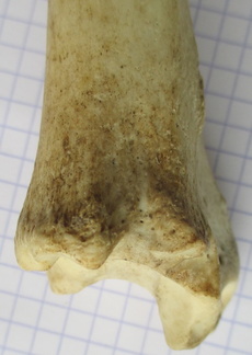 Tibia D dist lat