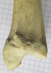 Tibia D dist med