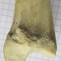 Tibia D dist med