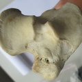 Tibia D prox (15618 visites) Tibia D prox