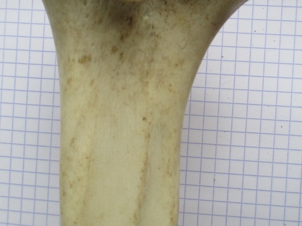 Tibia D prox caud (12456 visits) Tibia D prox caud