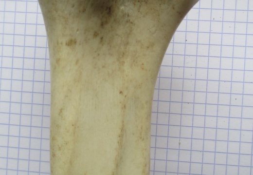 Tibia D prox caud (12456 visites) Tibia D prox caud