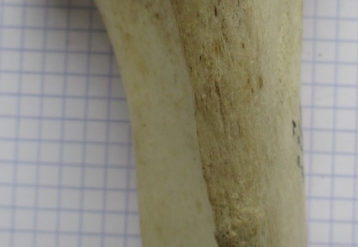 Tibia D prox cran (12795 visites) Tibia D prox cran