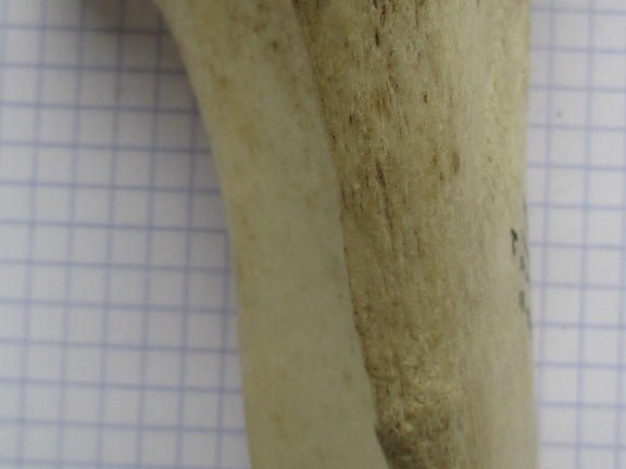 Tibia D prox cran (12857 visites) Tibia D prox cran