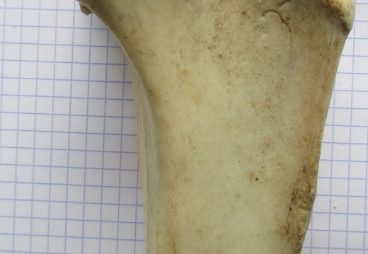 Tibia D prox lat (12986 visites) Tibia D prox lat