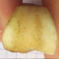 PH1 dist (14853 visites) PH1 dist