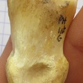 PH2 axial (14749 visites) PH2 axial