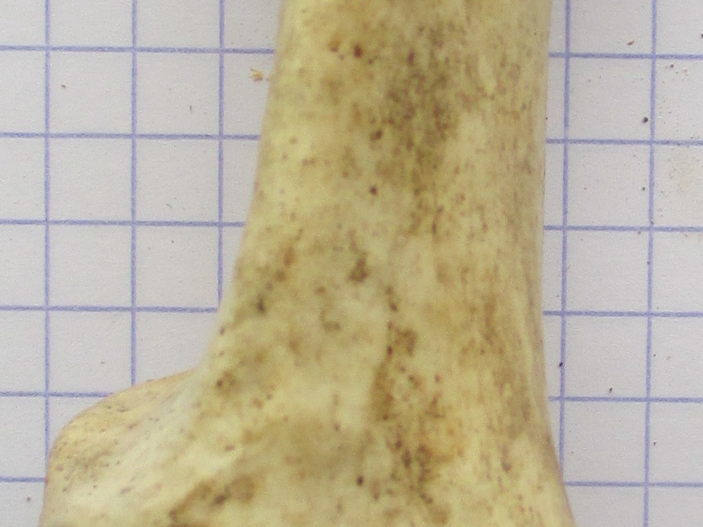 Calcaneum dors (16795 visites) Calcaneum dors