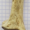 Calcaneum dors