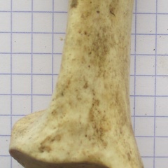Calcaneum dors (16787 visites) Calcaneum dors