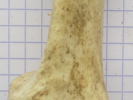 Calcaneum dors