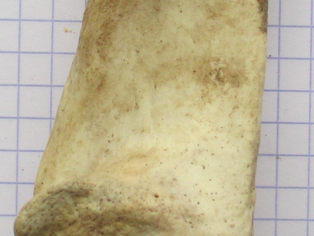 Calcaneum med1 (14213 visites) Calcaneum med1