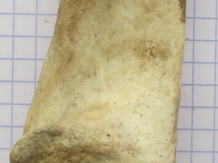 Calcaneum med1 (14223 visites) Calcaneum med1